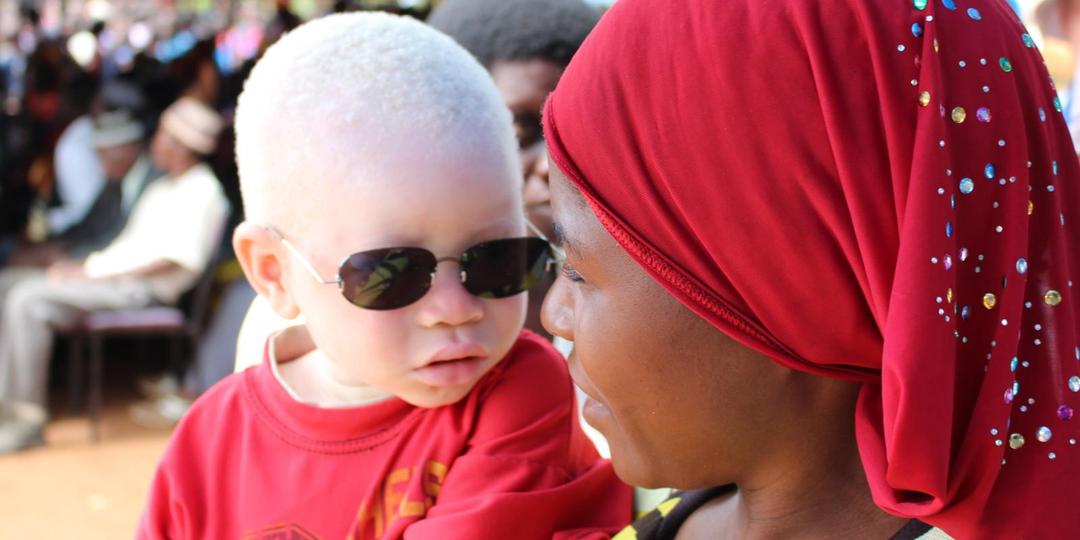 Black mom with child with albinism